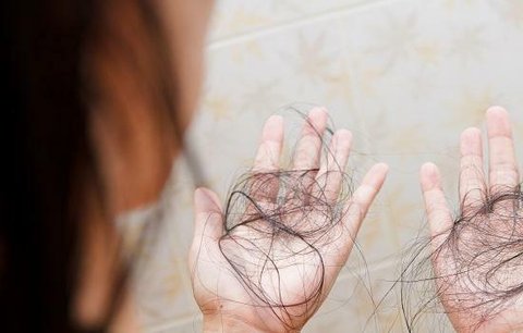 Trápí vás vypadávání vlasů? Poradíme vám, co funguje
