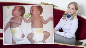 Kateřina Klasnová z nadace KlaPeto chce pomoci rodině malého Vojtíška, který přišel po porodu o nožičky. Jeho bráška Štěpánek se narodil zdravý.