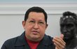 Hugo Chávez