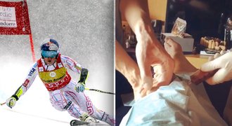 Simulace? Ani náhodou! Lyžařka Vonn v bolestech, brali jí krev z kolena