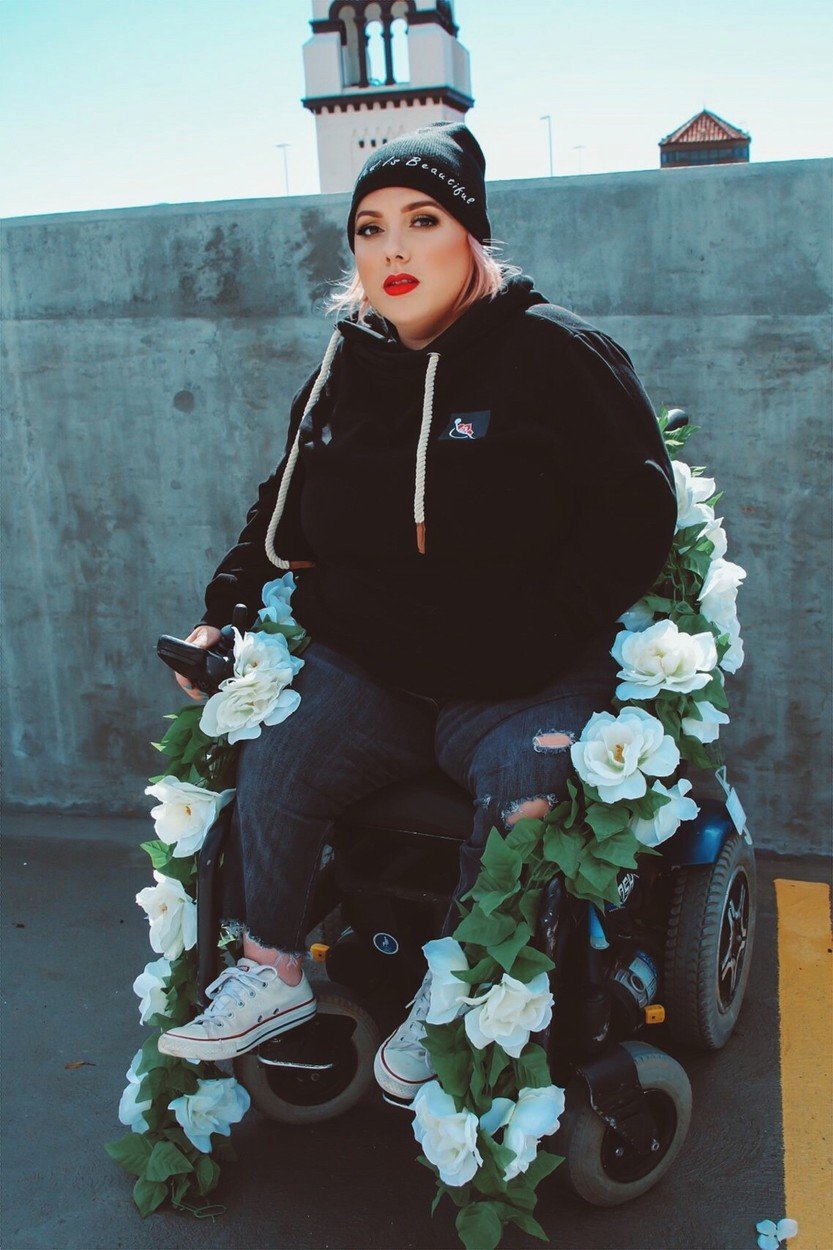 Tato žena z Kalifornie trpí od dětství artrogrypózou a je odkázána na invalidní vozík.