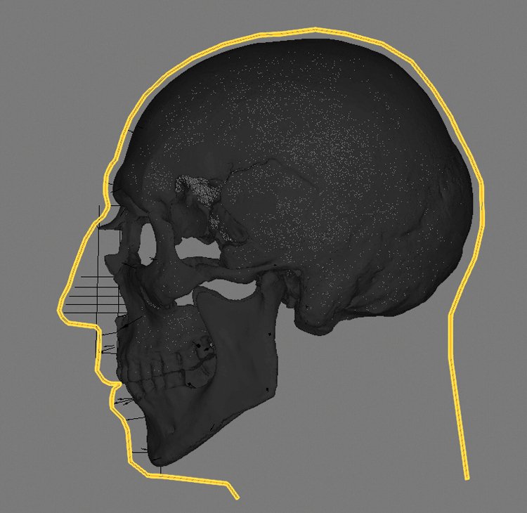 Rekonstrukce obličeje vždy vychází ze svalových úponů na kostech, na které 3D specialista nanese svalovou hmotu. Na snímcích vidíte i vyznačené body, které určují tloušťku dalších měkkých tkání