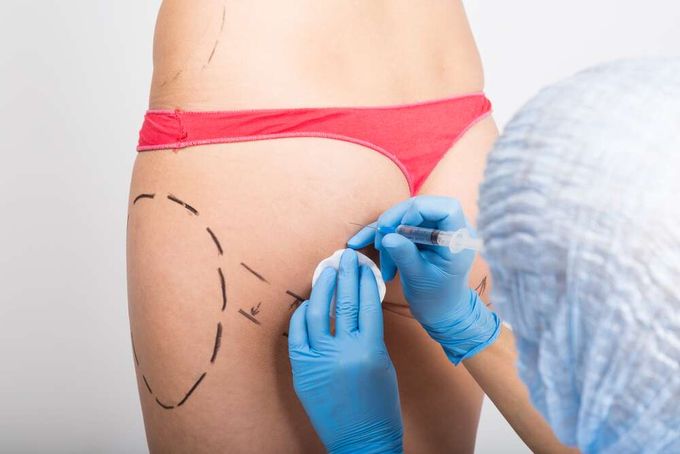 Počet plastických operací skokově roste. Jaké jsou důsledky? Počet plastických operací skokově roste. Jaké jsou důsledky?