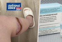 „Všechnu poslali vojákům!“ Ruským městům chybí vakcína na smrtelnou vzteklinu