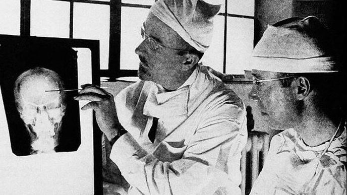 Neurol Walter Freeman Neurol Walter Freeman