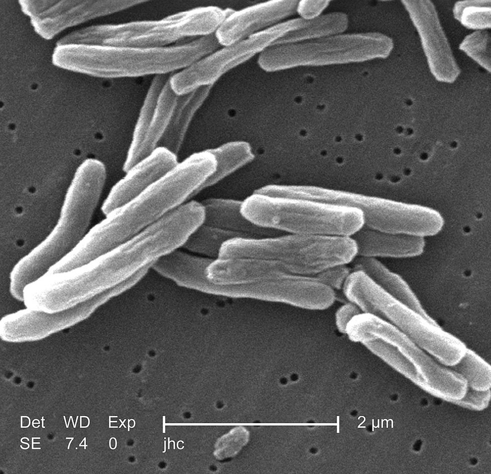 15549x zvětšený bacil Mycobacterium tuberculosis.