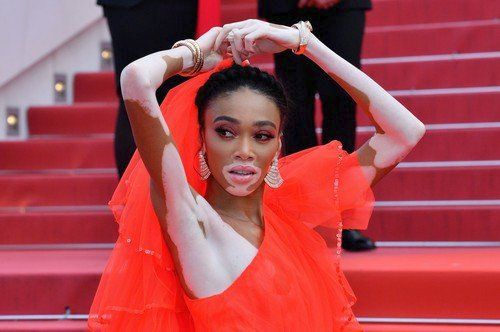 Winnie Harlow