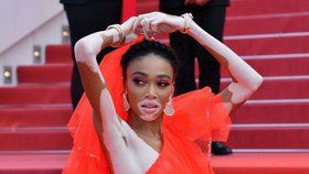 Winnie Harlow