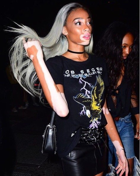 Winnie Harlow