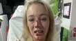 Wisemanová měla po útoku otevřenou zlomeninu nosu, rozseklý ret a vyražené dva zuby