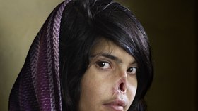 Afghánská dívka měla nakonec štěstí, v USA jí díky této fotografi i z časopisu Time pomohli plastičtí chirurgové