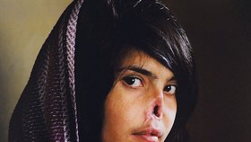 Vítěz soutěže: Fotografka Jodi Bieber z Jižní Afriky se stala absolutní vítězkou pro rok 2011. Porotu uchvátila svým portrétem mladé afghánské dívky, které její manžel uřízl nos. Potrestal ji tak za to, že utekla z domu poté, co ji trýznil. Především díky zveřejnění fotografie žije nyní Bibi v New Yorku a stará se o ni tým plastických chirurgů. Je to navíc vůbec poprvé v historii soutěže, kdy vyhrál portrét.