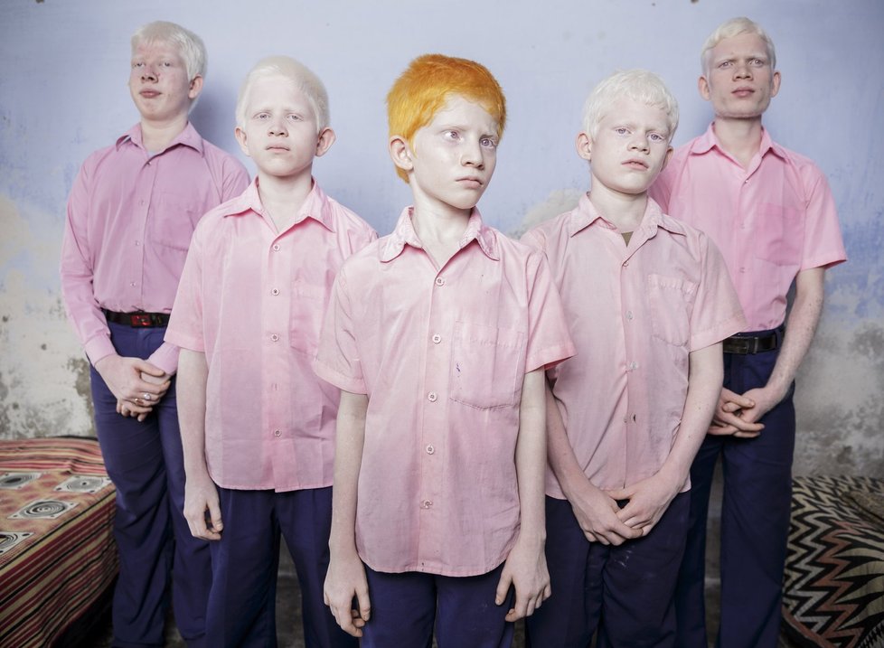 První místo v kategorii nastavených portrétních fotografií patří Brettu Stirtnovi za fotografii slepých albínů.