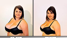 Zmenšení prsou bez operace: Vysáli jí 2 litry tuku!