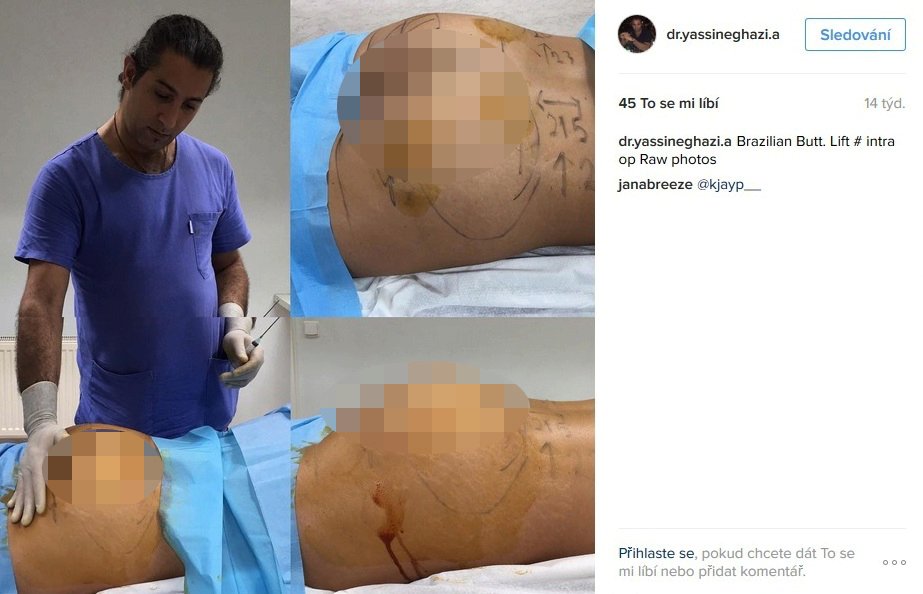 Yassine Ghazi se zadnicí své pacientky