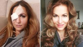 Yvetta Blanarovičová už nevypadá jako Žižka: Ukázala se bez obvazu, ale i make-upu!