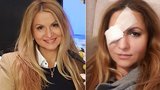Yvetta Blanarovičová skončila v Motole: Napíchla se okem na větev!