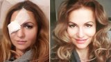 Yvetta Blanarovičová už nevypadá jako Žižka: Ukázala se bez obvazu, ale i make-upu!