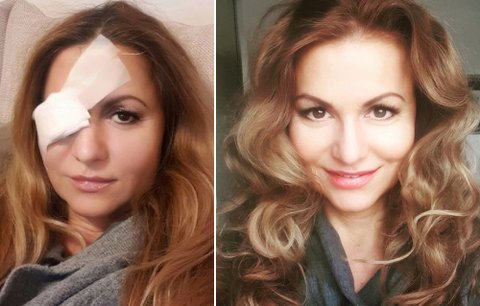 Yvetta Blanarovičová už nevypadá jako Žižka: Ukázala se bez obvazu, ale i make-upu!