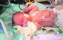 Zázračný příběh maličké Evy: Přežila 28 minut  bez kyslíku!