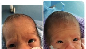 Dvojčata Zaki a Malika se narodila o tři měsíce dřív.
