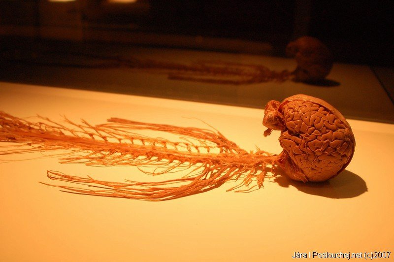 Bude letošní výstava mrtvých těl v Česku zároveň ta poslední?