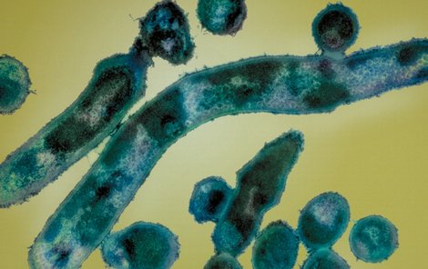 Bakterie Corynebacterium diphteriae jsou původcem onemocnění. 