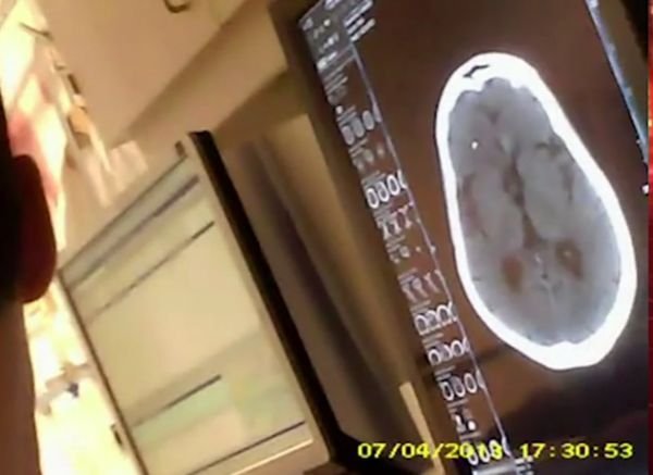 Snímek z CT lebky Bartošové na monitoru v ordinaci ambulance