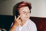 Do smrti budu mít kvůli alkoholikovi znetvořený ukazovák, postěžovala si Zdeňka Uherková (62), která má pod okem monokl