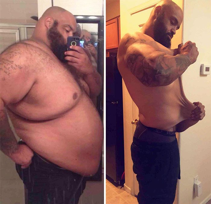 Řekli mu, že umře, pokud nepřestane jíst. Nakonec zhubl o 147 kilogramů.