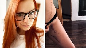 Markéta (26) málem přišla o nohy. Když ostatní zírají, tvrdím, že mě pokousal žralok!