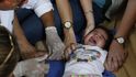 Měření dětí s podezřením na mikrocefalii, Brazílie - ilustrační foto