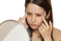 Kruhy pod očima: Šedé signalizují únavu, červené alergii a žluté jaterní problémy
