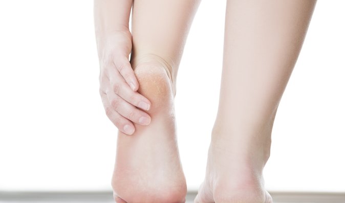 Trápí vás suché a popraskané paty? Změňte ponožky