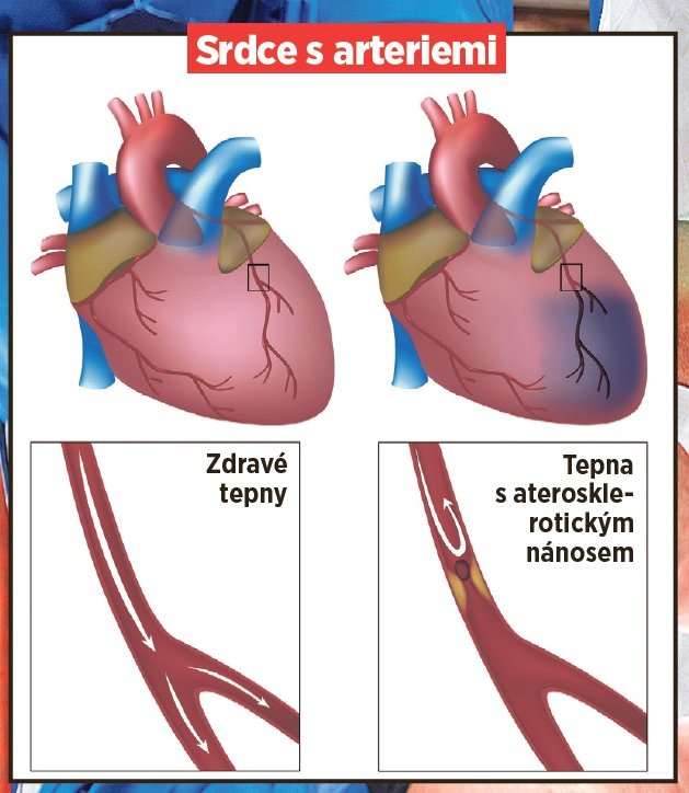 Srdce s arteriemi
