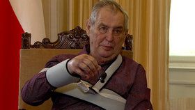 Prezident Zeman má  operovanou ruku očividně stále ještě nateklou. (CNN Prima NEWS, datum vysílání 6. 9. 2020)