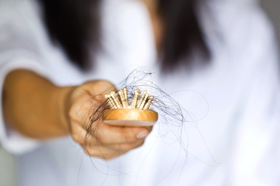 Padání vlasů je častý problém, který se špatně řeší.