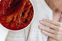 Kolik kroků denně proti infarktu? Čeští kardiologové zveřejnili nová čísla