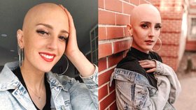 Doma se nestydím, ale ven nosím paruku, říká krásná dívka s alopecií