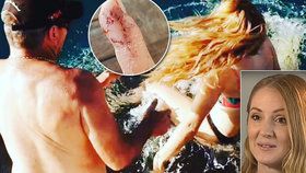 Šokující video: Ženu během krmení chytl žralok za prst a vtáhl do vody!