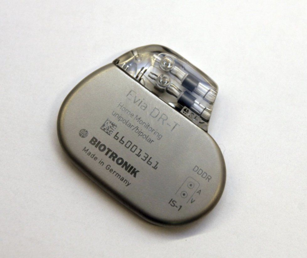 Kardiostimulátor (ilustrační foto)