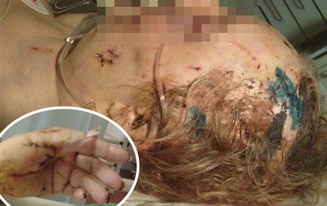 Útočník seniorku bodal nožem, pak jí rozbil o hlavu lahev sektu...