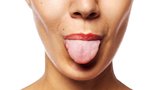 Trápí vás zápach z úst? Může za to váš jazyk!