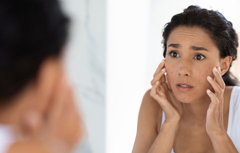 Toxické nároky: Tohle je 5 přehnaných standardů krásy. Přestaňte se o ně snažit!