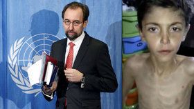 Vysoký komisař OSN pro lidská práva Zajd Raad Husajn kritizoval hladovění civilistů v Sýrii.