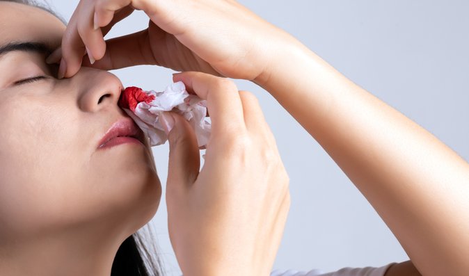 Časté krvácení z nosu: Kdy je to v pořádku a kdy je čas navštívit lékaře?