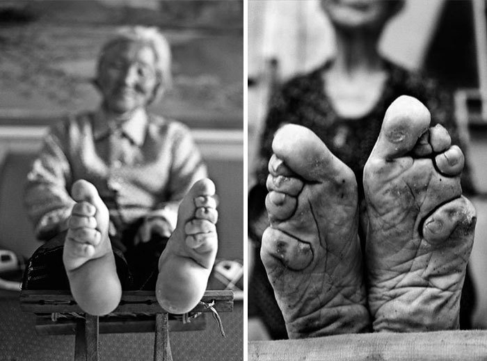Známá čínská tradice - stahování dívčích nohou kvůli jejich zmenšení.