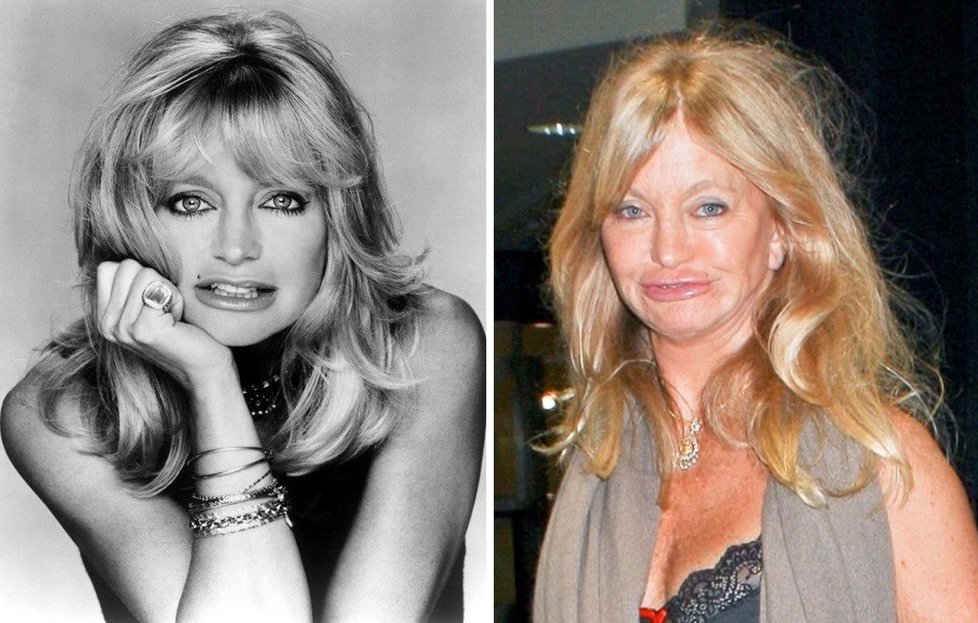 Goldie Hawn