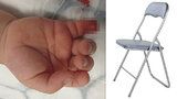 Skládací židle chlapci (6) z Jablonce usekla prst: Prodávají ji desítky obchodů