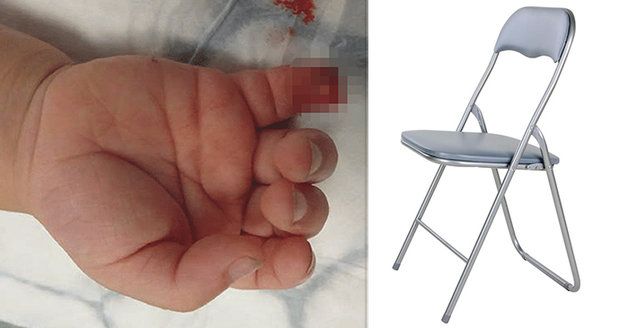 Skládací židle chlapečkovi (6) usekla prst: Prodávají ji desítky obchodů (ilustrační foto)